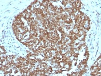 NCL / Nucleolin Antibody (aa364-365, clone 364-5 + NCL/902, Ready-to-Use)