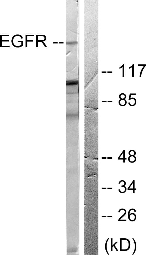 IHC-plus™ Polyclonal Rabbit anti-Human EGFR Antibody (aa651-700, IHC, WB)