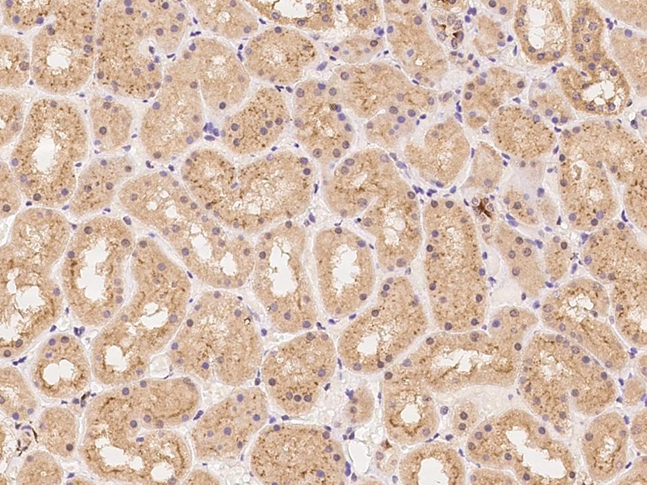Polyclonal Rabbit anti-Human SYNGR3 / Synaptogyrin 3 Antibody (IHC)
