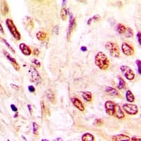 HNRNPC / HNRNP C Antibody (C-Terminus)