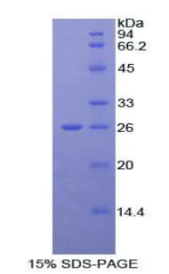 Mouse SPTAN1 / Alpha Fodrin Protein (Recombinant His)