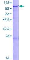 Human PLOD / PLOD1 Protein (Recombinant GST)