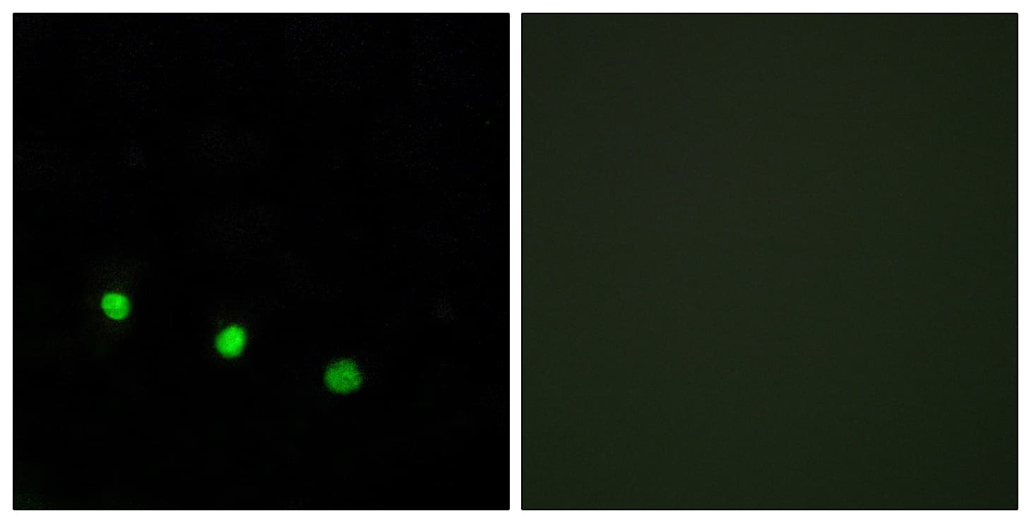 FOSB Antibody (phospho-Ser27)
