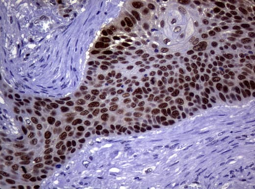 MGMT Antibody (clone UMAB56)