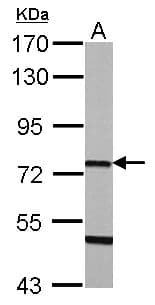 IHC-plus™ SCG2 / Secretogranin II Antibody