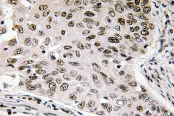 NIFK / MKI67IP Antibody (Asp229)