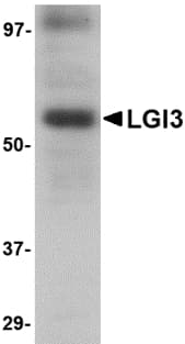 IHC-plus™ Polyclonal Rabbit anti-Human LGI3 Antibody (IHC, WB)