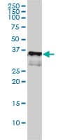 CD1A Antibody (clone M1-2-1B5)