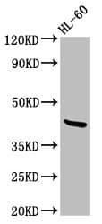 CerS6 / LASS6 Antibody