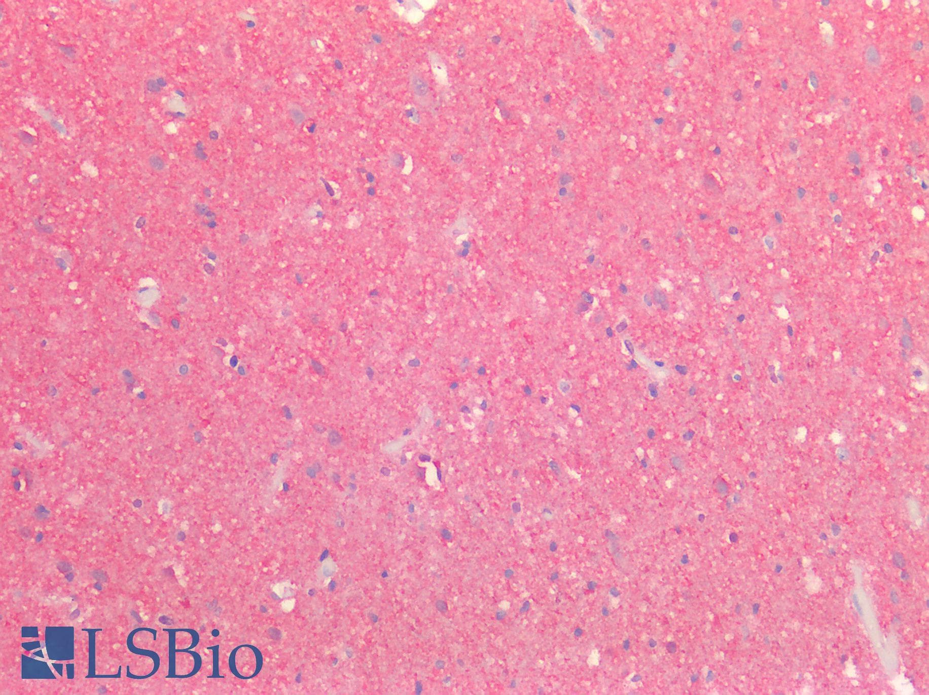 PathPlus™ TTR / Transthyretin Antibody