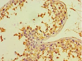 Polyclonal Rabbit anti-Human CHRFAM7A Antibody (aa1-150, IHC)