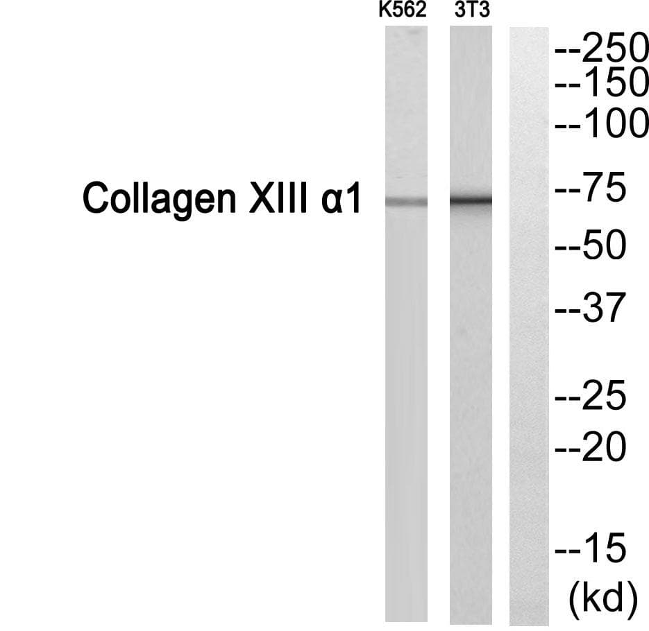 COL13A1 / Collagen XIII Antibody