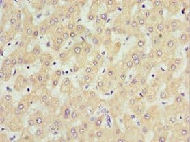 Polyclonal Rabbit anti-Human SOST / Sclerostin Antibody (aa24-213, IHC, WB)
