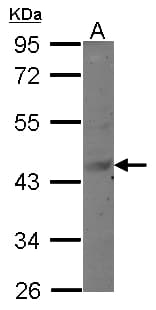 MAGEB6 Antibody