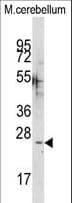 CABP / CABP1 Antibody (aa311-343)
