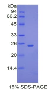 Mouse UCHL5 / UCH37 Protein (Recombinant His)