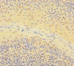 IKZF1 / IKAROS Antibody