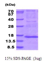 Human MRPS28 Protein (Recombinant His)