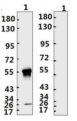 Recombinant Monoclonal Human anti-Coronavirus SARS-CoV-2 Nucleoprotein Antibody (WB)