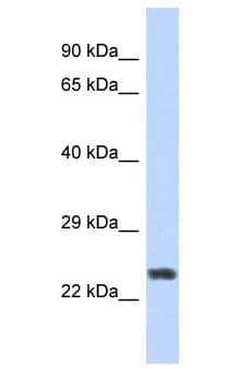 Polyclonal Rabbit anti-Human ZNF141 Antibody (aa49-98, WB)