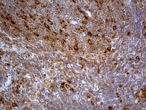 ABCF2 Antibody (aa1-235, clone OTI8F4)