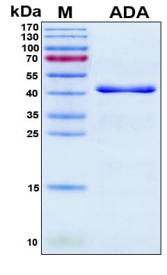 Human ADA / Adenosine Deaminase Protein (Recombinant 6His, N-terminus)
