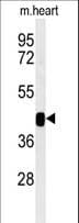 IHC-plus™ B3GNT7 Antibody (aa256-282)
