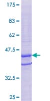Human TPD52L3 Protein (Recombinant GST)