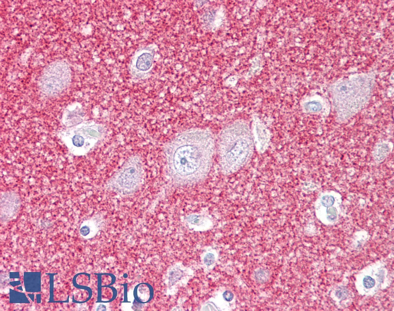 IHC-plus™ SNCB / Beta-Synuclein Antibody (aa85-134)