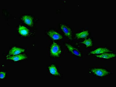 S1PR1 / EDG1 / S1P1 Antibody