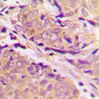 PFKM / PFK-1 Antibody (Internal)
