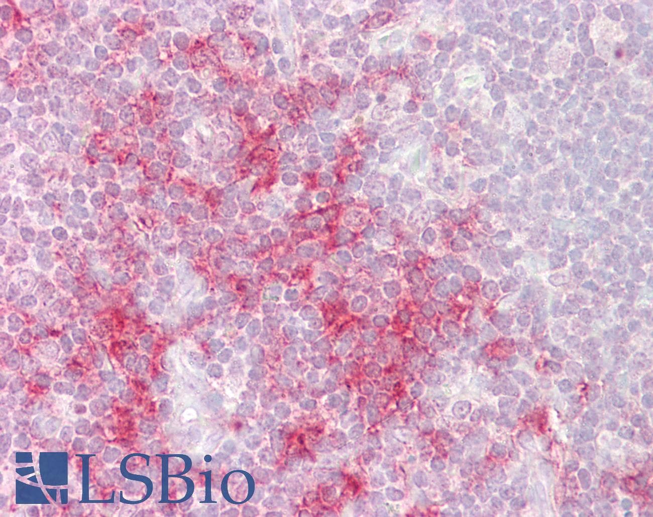 IHC-plus™ Polyclonal Goat anti-Human TRAF1 Antibody (aa270-282, IHC, WB)