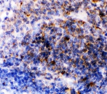 FCER2 / CD23 Antibody (aa50-331)
