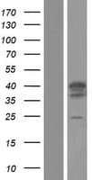 TRIM17 / RNF16 Protein (Over-Expression Lysate Myc-DDK (Flag))