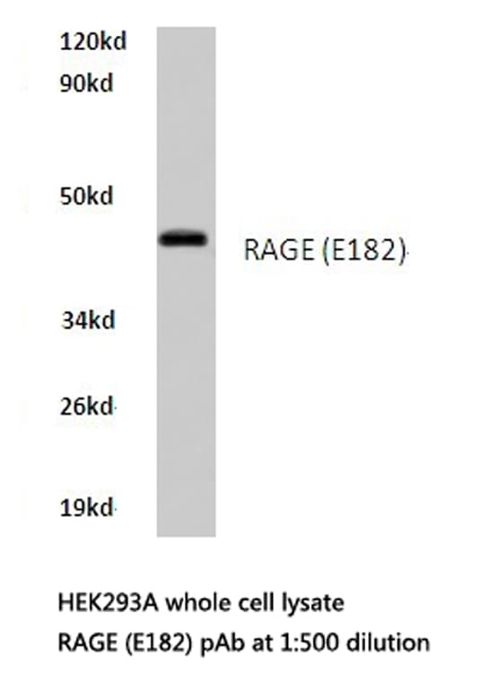 Polyclonal Rabbit anti-Human AGER / RAGE Antibody (Glu182, IHC, WB)