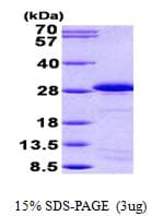 Human SPA17 / Sperm Protein 17 (Recombinant His)