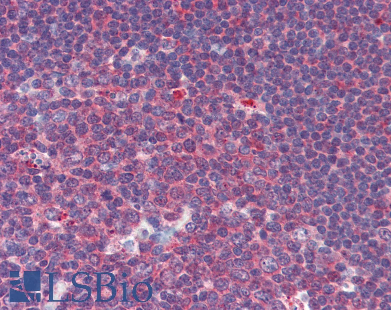 IHC-plus™ CUEDC2 Antibody