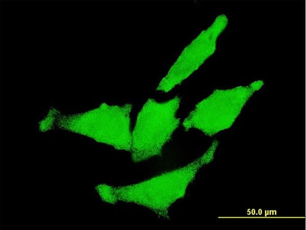 ERBB2 / HER2 Antibody (clone 3B1)