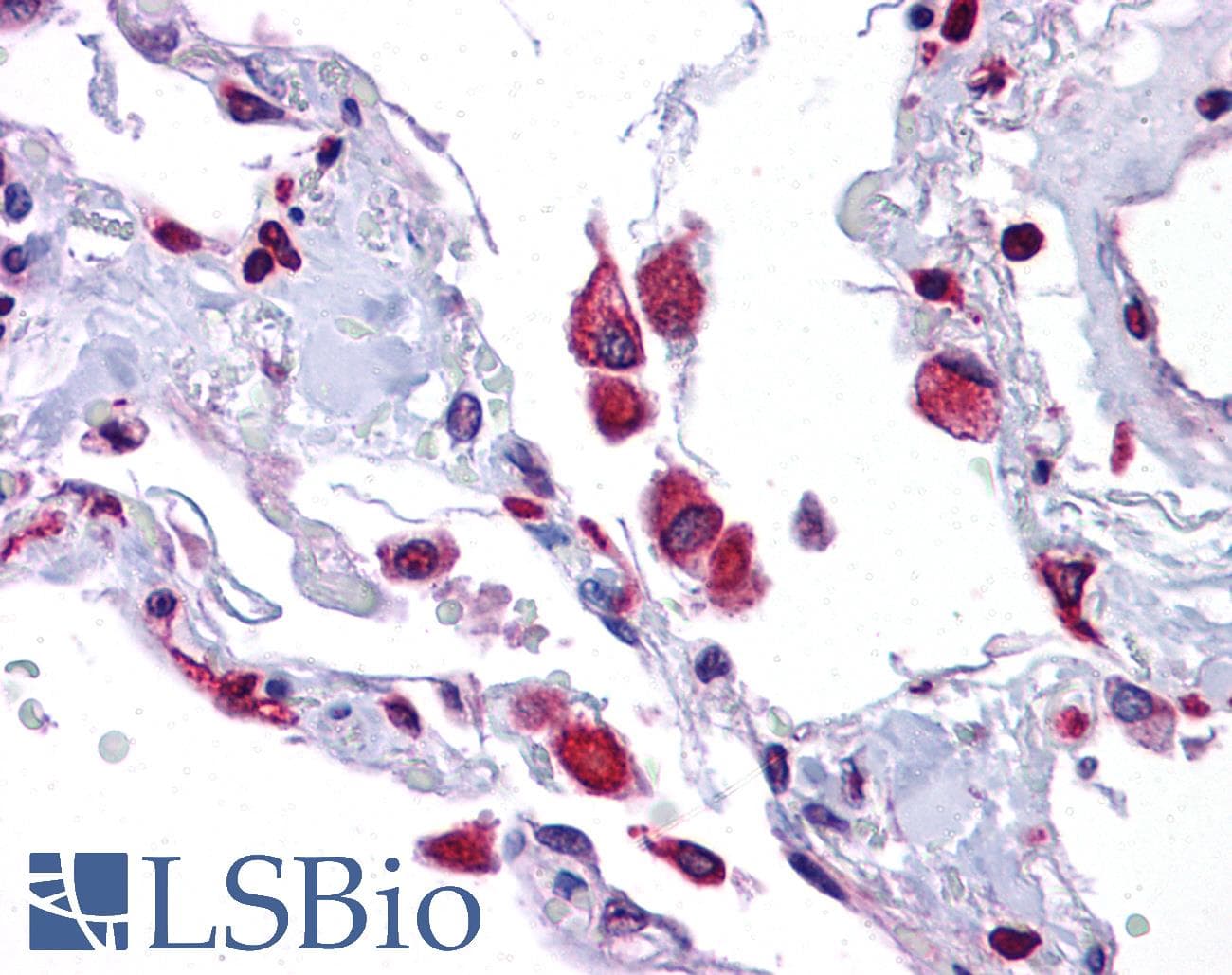 Polyclonal Rabbit anti-Human EIF2AK1 Antibody (aa108-157, IHC, WB)