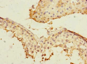 PLK3 Antibody