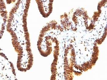 SUMO1 / SMT3 Antibody (clone SPM571)