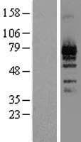 LZTS1 Protein (Over-Expression Lysate Myc-DDK (Flag))