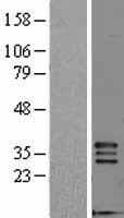 Human FGF5 Protein (Over-Expression Lysate Myc-DDK (Flag))
