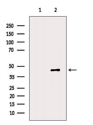 DNASE2B Antibody