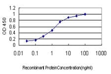 PathPlus™ S100A6 / Calcyclin Antibody (clone 6B5)
