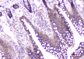 Polyclonal Rabbit anti-Human CDA / Cytidine Deaminase Antibody (IHC, WB)