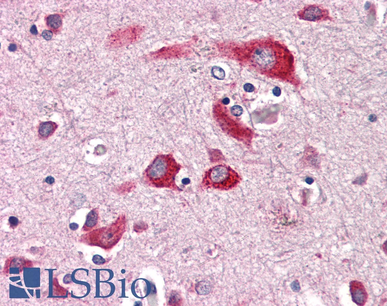 IHC-plus™ ENTPD2 Antibody (Internal)