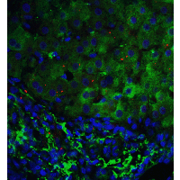 IHC-plus™ SIP / TP53INP1 Antibody