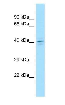 DUSP4 / MKP2 Antibody (aa325-374, Biotin)