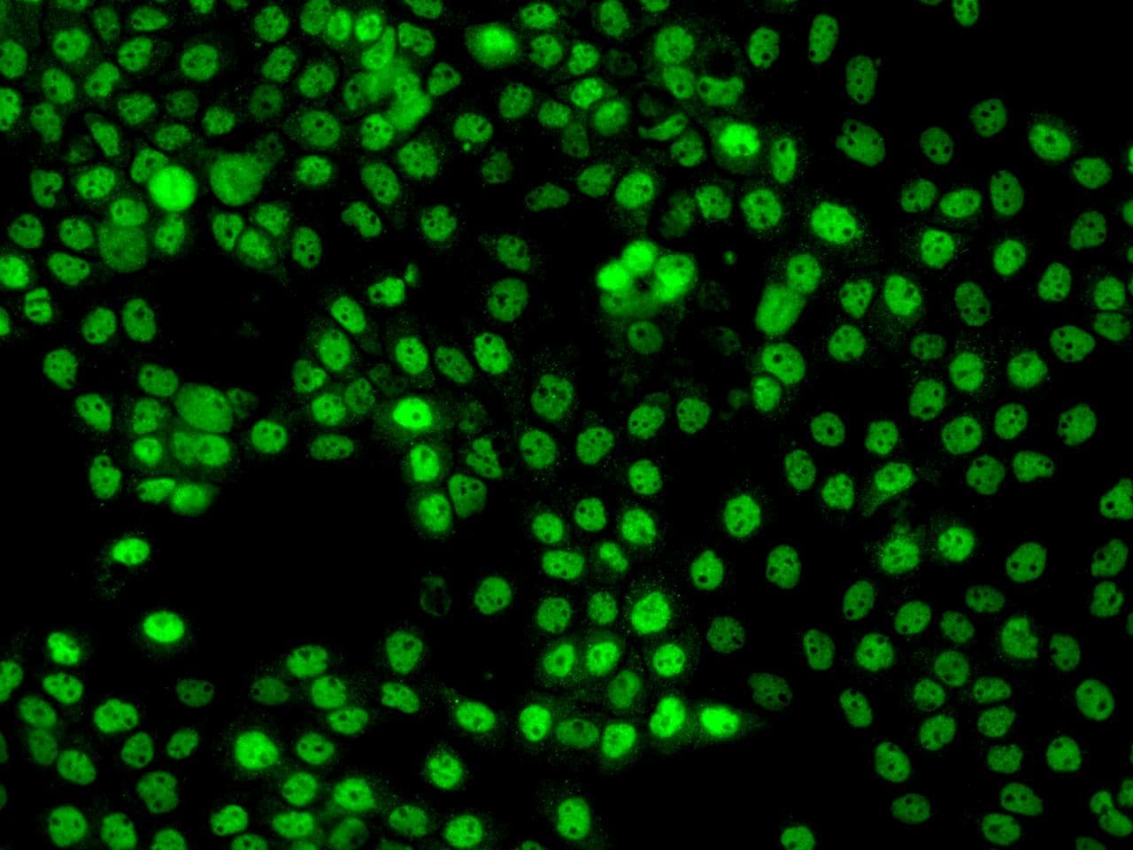 Polyclonal Rabbit anti-Human ZNF205 Antibody (IF)